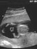 An image of my soon-to-be son or daughter.  Assuming the kid shows up on time, I'll let you know the gender in April 2003.